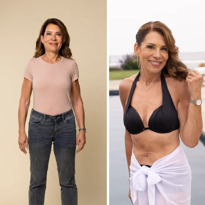 Roxanne, 67, before and after